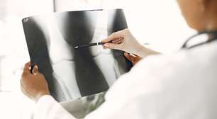 Dor crônica não é fraqueza: por que a ortopedia precisa ir além de remédios e infiltrações