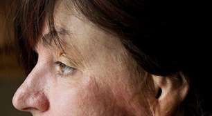 'Um incêndio mortal devastou a boate em apenas 90 segundos. Eu consegui sair'