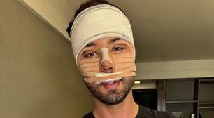 Encurtar as pernas, implantar terceiro seio, mudar região íntima: a obsessão dos famosos pelo corpo