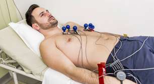 Por qual motivo os médicos indicam um eletrocardiograma antes de começar a treinar fortemente?