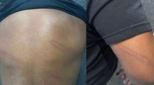 Perdigão, ex-Corinthians, é agredido por policial após jogo no Paranaense; veja vídeo