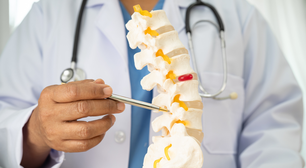Técnica inovadora pode substituir a cirurgia de hérnia de disco