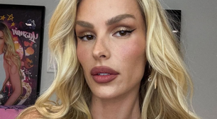 Yasmin Brunet mostra antes e depois de tratamento para lipedema e anuncia curso; veja fotos