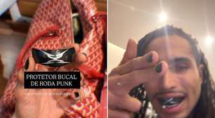 Matuê chama atenção ao exibir 'protetor bucal de roda punk' nas redes