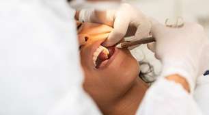 Você sabe o que fazer se quebrar um dente? Descubra!