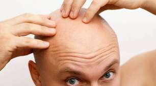 Finasterida e Minoxidil: avaliando riscos, efeitos colaterais e precauções médicas