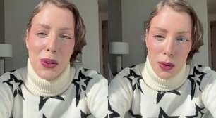 Fabiana Justus comove ao recordar diagnóstico de leucemia: 'Mudou tudo'