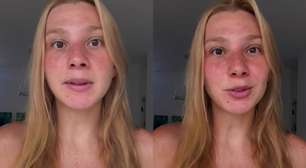 Daniella London faz esclarecimento após AVC aos 32 anos