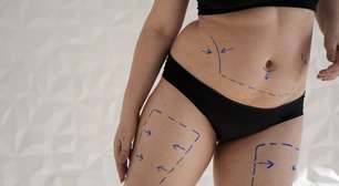 Abdominoplastia x Lipoaspiração: confira as principais diferenças