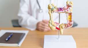 Segundo cérebro: a relação entre intestino e saúde mental