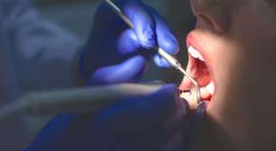 Quebrou um dente? Confira passo a passo do que fazer