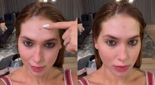 Virginia expõe marcas causadas por fantasia após ensaio da Grande Rio