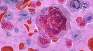 Por que a leucemia é o câncer mais comum em crianças e jovens?