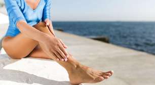 Calor piora inchaço nas pernas e indica risco circulatório