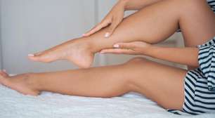 Varizes na adolescência? Pode acontecer! Entenda mais