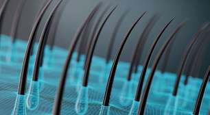 Achávamos que o cabelo apenas crescia, mas estávamos errados: ele é puxado para fora em espiral por uma engrenagem biológica