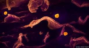 O que é quais são os sintomas do vírus Nipah