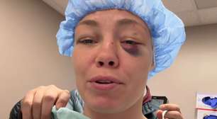 Culpa de brasileira? Ex-campeã do UFC passa por cirurgia e revela restrição após luta