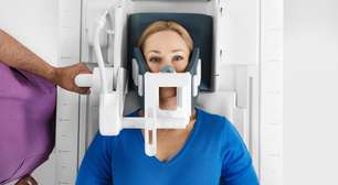 Ressonância magnética odontológica chega ao Brasil este ano