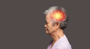 Cérebros envelhecidos aumentam o risco de morte e de Alzheimer