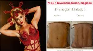 Virginia impressiona com antes e depois após drenagem linfática; conheça os benefícios