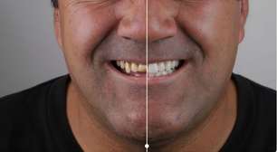 Tecnologia ajuda dentistas a prever resultados estéticos