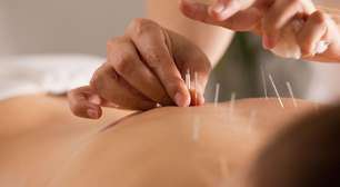 Fevereiro Roxo reforça acupuntura no cuidado da fibromialgia