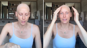 Com câncer, atriz ex-SBT desabafa sobre quimioterapia e reforça importância do SUS: 'Sou privilegiada'