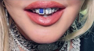 Preço de um carro? Madonna choca web com valor de joia no dente