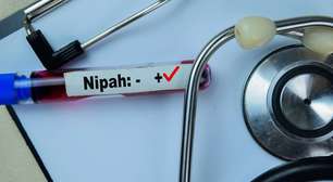 Do morcego ao porco: entenda a cadeia de transmissão do vírus Nipah