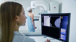 6 mitos e verdades sobre o câncer de mama e a mamografia