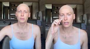 Atriz Dani Gondim desabafa sobre quimioterapia e autoestima: 'Sou privilegiada'