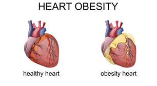 Gordura pericárdica: o risco silencioso para a saúde do coração