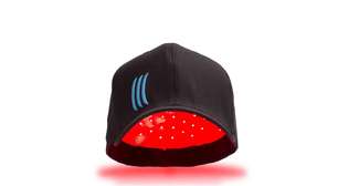 CryoFólic e ND2 marcam nova era do transplante capilar com tecnologia de congelamento e alta densidade