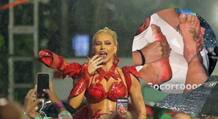 'Me faria desistir do Carnaval': Virgínia Fonseca choca ao mostrar pés em carne viva após ensaio técnico debaixo de chuva. 'Socorro'