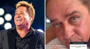 Poliana Rocha mostra resultado de cirurgia nos olhos de Leonardo: 'Rejuvenesceu 10 anos'