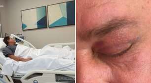 Leonardo mostra resultado de cirurgia plástica nos olhos: 'Rejuvenesceu 10 anos'