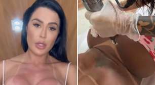 Gracyanne Barbosa inicia remoção de tatuagem íntima feita para Belo: 'Não foi fácil'