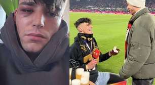 Árbitro é agredido dentro de casa após pedir namorado em casamento na Alemanha