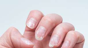 Para suas unhas pararem de quebrar, esses alimentos podem ser a solução