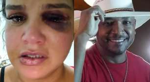 Cantor é suspeito de agredir e manter ex-companheira em cárcere privado em MG: 'Covarde'