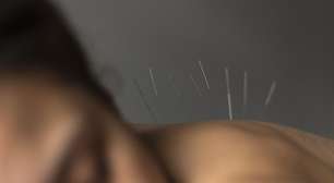 A acupuntura no tratamento da dependência química