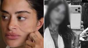 Ex-BBB Aline Campos faz mais uma cirurgia plástica e mostra resultado: 'Fluido'