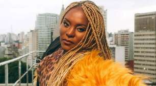 Sufoco! Ex-Rouge relata perrengue ao perder dente às vésperas do Carnaval: 'Deus ajude...'