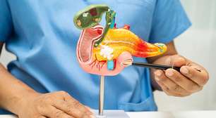 Casos recentes reacendem debate sobre câncer de pâncreas; doença está mais comum?