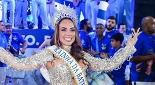 Herdeira de bilhões, vitória contra câncer no intestino e mais: 5 curiosidades da rainha de bateria da Águia de Ouro, Renata Spallicci