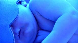 Do fígado às vias biliares: o que a icterícia revela sobre o corpo