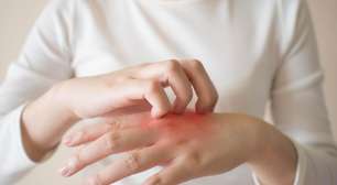 Formigamento nas mãos e braços? Veja o que pode ser e o que fazer