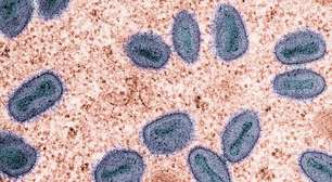 Não é a Covid: cientistas emitem alerta sobre 3 vírus silenciosos que já estão entre nós e ameaçam 2026