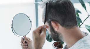 Alopecia androgenética: entenda a condição que afeta a cantora Maiara